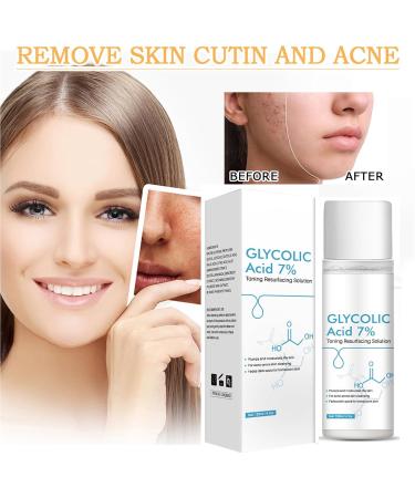 Mikabila 120ml Glycolic Acid 7% Toning Resurfacing Solution Glycolic Acid Toner Moisturize & Strengthen Skin Glycolic Sour 7% Toner Hydrating Toner Rejuvenate Moisturize & Strengthen Your Skin - Buy Online on GoSupps.com