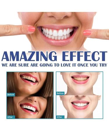 7 Day Active Gum Treatment Antibacterial Gum Treatment Gel Anti-Yellowness Serum for Stain Treatment Gum Treatment Gel Oral Cleaning - Buy Online on GoSupps.com