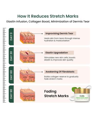 Healoofy Naturals Stretch Mark Cream Powered with bio actives | For Pregnancy | Scar removal and Moisturizing Cream Stretch Mark removal for Stomach thighs & all body parts (200G Pack of 2) - Buy Online on GoSupps.com