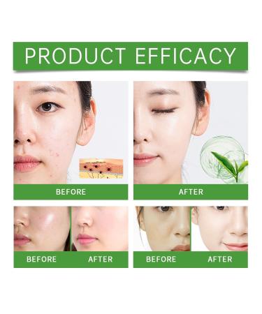 Refreshing Oil-Control Cleansing Gel - Gentle & Moisturizing Facial Wash For Deep Cleansing(2PCS) - Buy Online on GoSupps.com