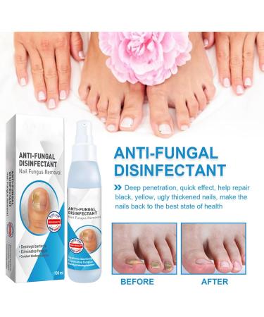 WJnflQN Nail StrengtheningFoot Nail Nourishing Spray 100ml Nonsticky Strengthening Spray for Damaged Cracked Brittle Nails for Daily Hand and Foot Care - Buy Online on GoSupps.com