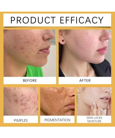 Turmeric Clay Mask - Face Masks Skincare - Hydrating Face Mask for Dark Spots - Even out Skin Tone Face Care - Vitamin C Clay Face Mask Control Oil and Refining Pores - Buy Online on GoSupps.com