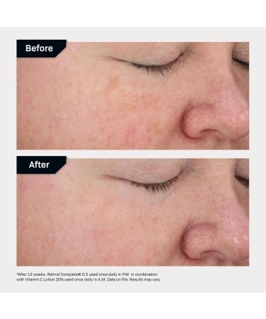 Revision Skincare Vitamin C Lotion - Daily Anti-Aging Brightening & Moisturizing Formula | 30% Vitamin C for Fine Lines & Wrinkles - Buy Online on GoSupps.com