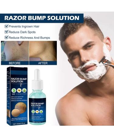Ingrown Hair Treatment - 30ml Razor Bumps Solution | Mild Moisturizing After Shave Repair Serum for Men - Buy Online on GoSupps.com