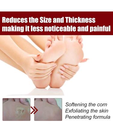 KODEQ Foot Corn Removal Gel Cream - Callus Remover Liquid for All Skin Types - Buy Online on GoSupps.com