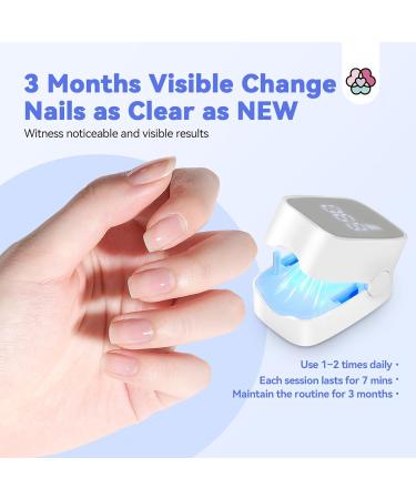 SAVILAND Nail Fungus Cleaning Device Faster: Max-Effective 905nm Infrared Light 470nm Blue Light Defeat Fungi Nail Fingernail Fungus Toenail Fungus Safer Painless Rechargeable Fungi Cure Home Use - Buy Online on GoSupps.com