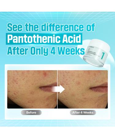 numbuzin No.1 Acne & Sebum Control Set | Calming Herb Toner + B5 Soothing Cream for Redness and Breakouts - Buy Online on GoSupps.com