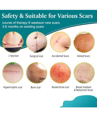 Silicone Scar Sheets Reusable Medical Grade Thinken Scar Sheet for C-Section Tummy Tuck Keloid Surgical Scars Post Surgery Supplies (16pcs-5.9"x1.6"Each Silicone Scar Sheet) - Buy Online on GoSupps.com