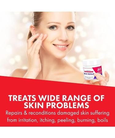 Natrulo Skin Repair Cream for Eczema, Itch Relief, Burns, and more | Natural All Purpose Ointment | Repair Rescue Skincare Salve - Buy Online on GoSupps.com