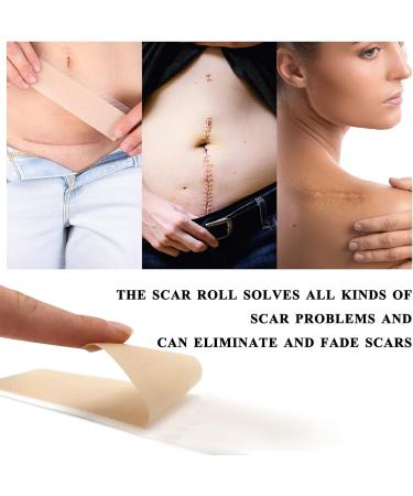 Silicone Scar Patch 4cmx150cm - Effective Treatment for Scars from C-Section Burns Keloids & Acne | Medication-Free Solution - Buy Online on GoSupps.com
