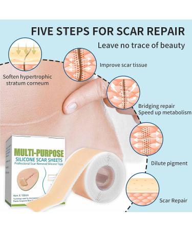 Medical Grade Silicone Scar Sheets - 1.6 x 60 inches - C-Section, Keloids, Tummy Tuck - Reduce Scarring and Promote Healing - Buy Online on GoSupps.com