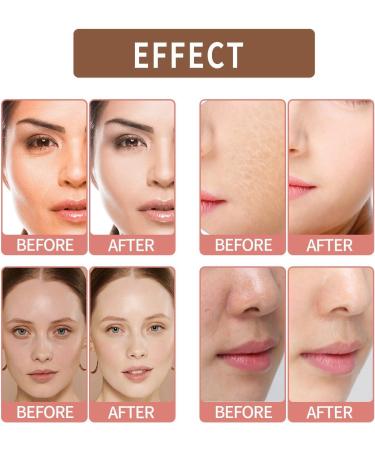 Glutathione Face Cream Glutathione Anti-Aging Face Cream for Women & Men Glutathione Hydrating & Whitening Cream Dark Spot Remover for Face Skin Brightener Cream Face Moisturiser Skin Care Moisturizer - Buy Online on GoSupps.com