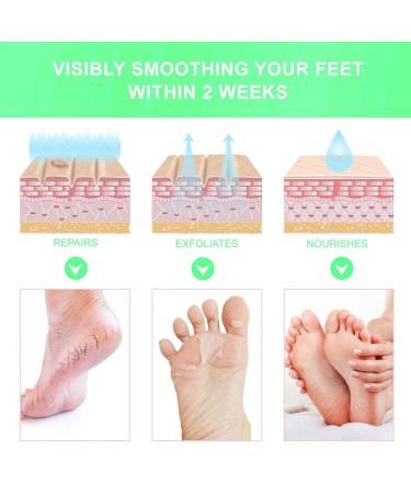 Foot Mask Peeling Pedicure - Silky Velvet Soft Feet | Lavender Moisturizing Foot Peel & Corn Remover - Buy Online on GoSupps.com