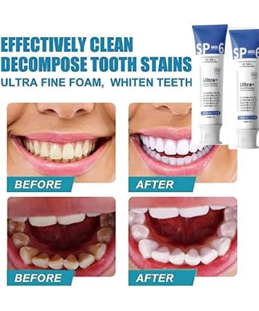 SP-6 Ultra Whitening Toothpaste - Probiotic Brightening Deep Cleaning Maximum Fresh Breath | International Shipping Available - Buy Online on GoSupps.com