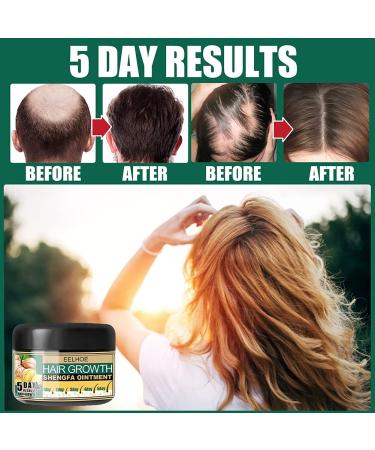 Ginger Hair Growth Ointment - Hair Regrowth Serum for Hair Loss Treatment - Scalp Massage Essence Cream - 30g/1 OZ Sample - Buy Online on GoSupps.com
