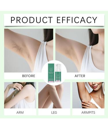 Gentle and Soothing Hair Removal Cream - Underarm Hair Removal Cream | For Men Women Girlfriend Wife Daughter Father Boyfriend Bikini Pubic Area Intimate Areas Legs Arms - Buy Online on GoSupps.com