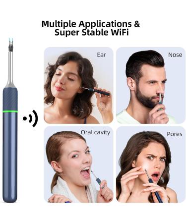 1920P FHD WiFi Ear Wax Removal Kit with Camera for Adults Kids Pets - Blue - Buy Online on GoSupps.com