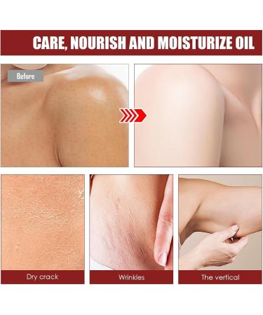Yooyan Body Oil Glow Straff body oil lifting skin firming body oil beauty for dry skin reduces fine lines sagging skin care oil soft formula all - Buy Online on GoSupps.com