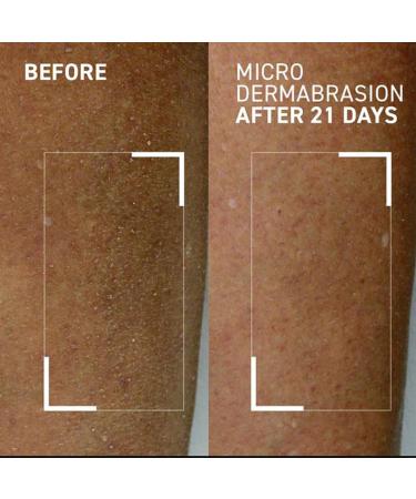 Dr. Brandt Microdermabrasion Body Polishing Exfoliator - Exfoliate Rough Dull Skin | Improve Body Skin Appearance - 4.4 oz - Buy Online on GoSupps.com