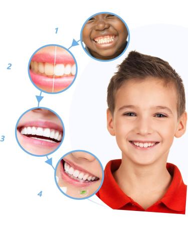 Gleavi 20 pcs Soft Travel Toothbrush Set - Sensitive Bristles for Kids & Adults | Perfect for On-the-Go Oral Care - Buy Online on GoSupps.com