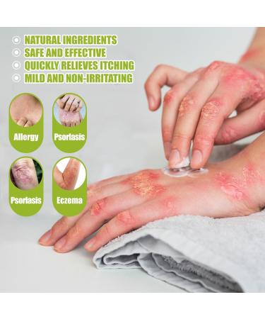  MagiSel Ringworm cream soothing anti-itch cream ready-to-use cream body cream for redness and itching relief skin itching relief - Buy Online on GoSupps.com