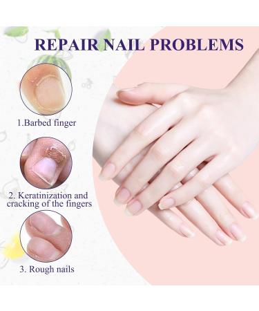 LINXINS 3PCS Cuticle Oil Pen for Nails Nail Oil Pen with Natural Ingredients Revitalize Pen Cuticle Revitalizer Oil Pen with Soft Brush for Nail Care Prevent Nail Cracking and Dry - Buy Online on GoSupps.com