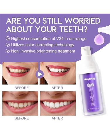 V34 Whitening Toothpaste - Colour Corrector for Brighter Teeth, Stain Removal and Yellowing Reduction - Buy Online on GoSupps.com