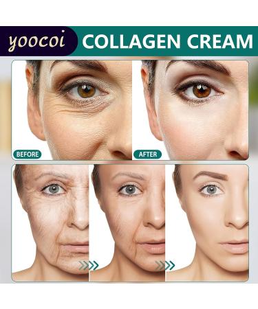 Yoocoi Collagen Cream - Anti Aging Day & Night Moisturizer with Hyaluronic Acid & Vitamin C for Smooth, Firm Skin - Buy Online on GoSupps.com