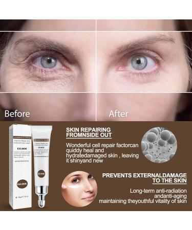 Collagen Retinol Under Eye Cream | Anti-Aging Solution for Dark Circles & Puffiness | Smooth Fine Lines - 0.7 oz - Buy Online on GoSupps.com