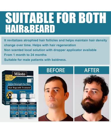  Miioto Miioto Hair Growth Serum Anti-Hair Loss for Men Hair Loss Very Fast Hair Growth Hydrates Roots and Regrowth - Buy Online on GoSupps.com