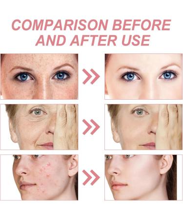 4 in 1 Anti Aging Face Serum Vitamin C Serum For Face Facial Serums for Women with 10% Niacinamide Fade Fine Lines&Improve Dull Tired Skin intense Firming Face Serum for Wrinkle Smooth Skin Tone-30ml - Buy Online on GoSupps.com