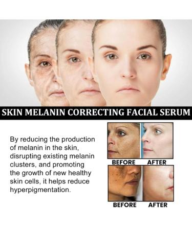 Gfuel 3Pcs Melanin Correcting Facial Serum Set | 2023 NEW Face Serum for Women - Buy Online on GoSupps.com