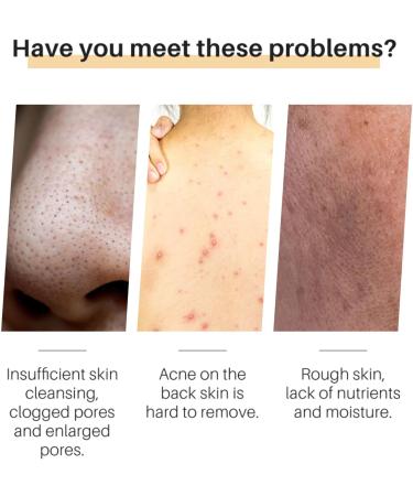 Turmeric Soap Turmeric Soap Bar Moisturizing Deep Clean Ginger Soap Moisturizing Natural Ginger Soap Bar Ginger Handmade Turmeric Exfoliating Soap Bar Natural Handmade Soap For body - Buy Online on GoSupps.com