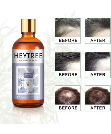 Heytree Rosemary Oil 100% Pure & Natural - 100ml Therapeutic Grade for Hair Growth Skin & Nails | Aromatherapy Diffuser Oil - Buy Online on GoSupps.com