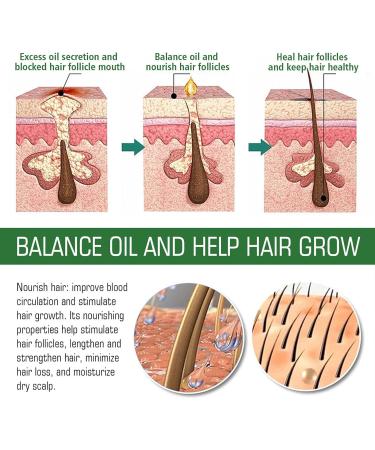 Rosemary Oil for Hair Growth Essential Oils Rosemary Hair Oil Organic Hair Products Scalp and Hair Strengthening Oil with Glass Dropper 2 fl oz oz Skin and hair care Novent - Buy Online on GoSupps.com