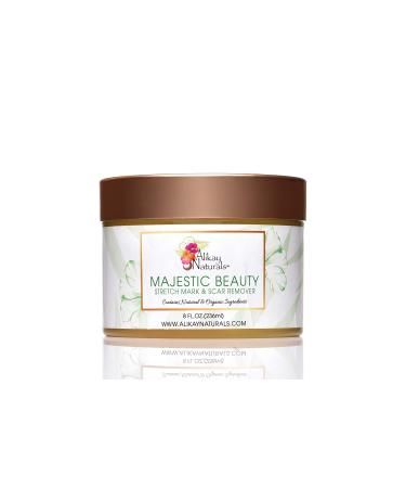 Alikay Naturals Majestic Beauty Stretch Mark & Scar Remover 8 Oz
