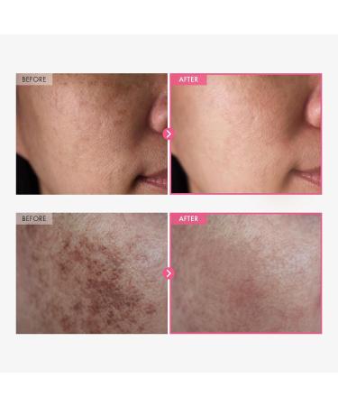 Radiance & Clarity Duo: TOSOWOONG Peach 80 Niacin Serum & Arbutin 7 Tranexamic Acid Cream for Glowing Skin - Buy Online on GoSupps.com