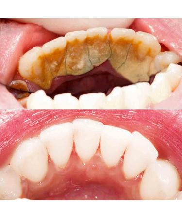 2PC CrystalClean Smile Powder - Mint Teeth Whitening Powder for Brightening & Lightening - 50g - Buy Online on GoSupps.com