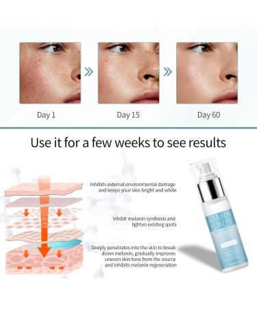 Advanced Pigmentation Remover Cream with Niacinamide Retinol & Vitamin C - Skin-Friendly Formula for All | International Shipping - Buy Online on GoSupps.com