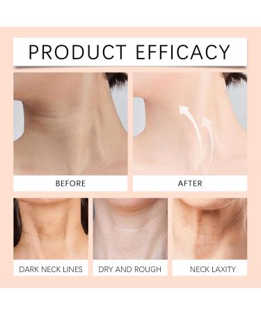  Hengxuan Collagen firming neck cream moisturizing and firming neck cream for women anti-aging formula to reduce wrinkles creases and sagging skin (1) - Buy Online on GoSupps.com