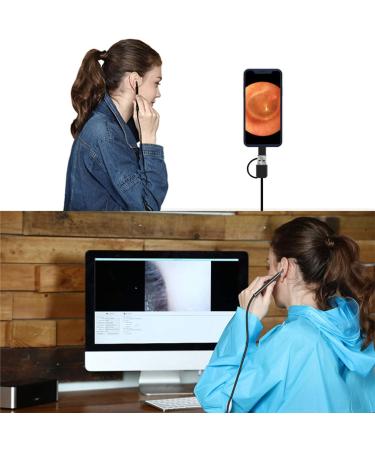 Sanon Otoscope Ear Wax Remover Camera with 6 Dimmable LED - HD Visual Camera for Adults, Kids, and Pets - Compatible with Android Tablet and PC - Buy Online on GoSupps.com