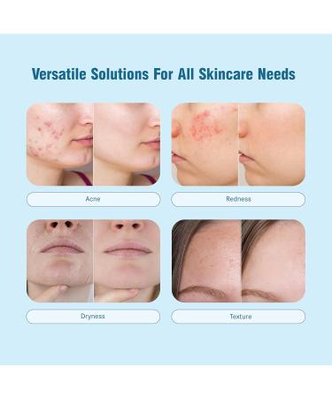 Think Smarter Products CPR Hydrating Facial Mist with Hypochlorous Acid Soothing Skin Care Solution for Hydration and Acne Breakouts Hypoallergenic Suitable for All Skin Types 8 fl oz (236mL) - Buy Online on GoSupps.com