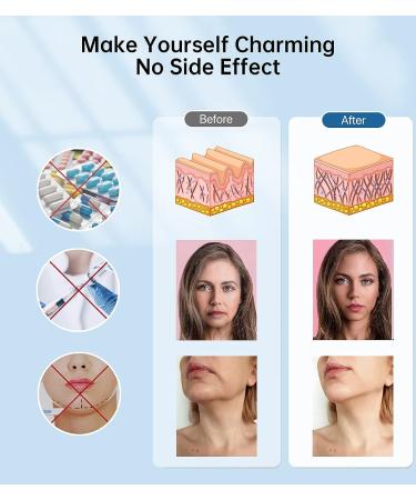 Sleepbeauty Double Chin Reduce Headband with Stereo Speakers - V Line Mask for Facial Slimming and Face Lifting - Buy Online on GoSupps.com