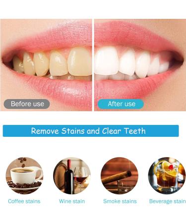 Lamkrtlp 28pcs Whitening Strips - Effective Teeth Whitening for Bright White Smile | Remove Yellow Smoke & Black Stains - Buy Online on GoSupps.com