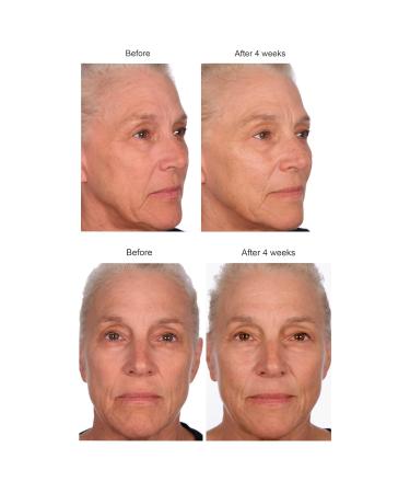 Buy Serious Skincare Black Pearl Deep Wrinkle Decrease Serum - Repair Deep Lines & Increase Skin Elasticity - Luminous Glowing Skin - 1 Fl. Oz - International Shipping Available - Buy Online on GoSupps.com