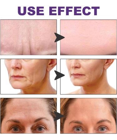 2 Facial Patches for Wrinkles 100 Facial Wrinkles Remover Strips Forehead Wrinkles Patches - Reusable Face Tape Smoothing Wrinkles Patches for Reducing Forehead Eye and Around Mouth Aezon 2 Pcs 100pcs - Buy Online on GoSupps.com
