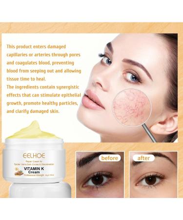 2PCS Varicose Veins Miracle Cream - Vitamin K Cream for Legs & Face Nourishing & Moisturizing for All Skin Types - Buy Online on GoSupps.com