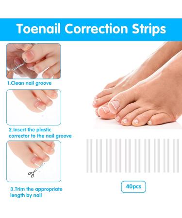 Jeffdad Ingrown Toenail Treatment Kit | Professional Removal & Correction | Lifter & Clipper Included | Quick & Effective Nail Repair - Buy Online on GoSupps.com