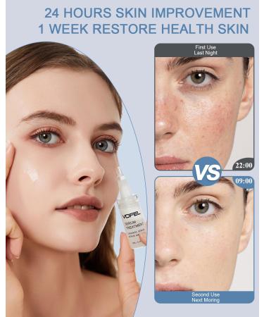 VOFEL Ceramide Serum for Skin Barrier Repair, 5% Ceramide Face Serum Ampoule Solution 2 Vials - Buy Online on GoSupps.com