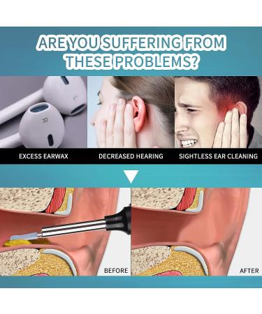 Wireless Ear Wax Removal Tool with 1080P Camera | Ear Cleaning Kit for iPhone, iPad, Android Phones - Black - Buy Online on GoSupps.com